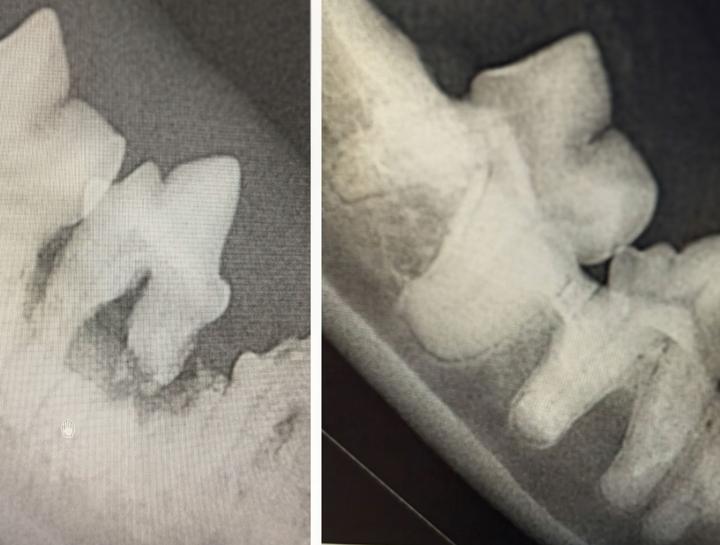 Digital Dental Radiology